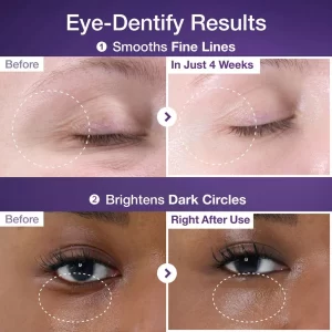 Alternative view of NUMBUZIN EYE CREAM نمبوزين كريم للعين